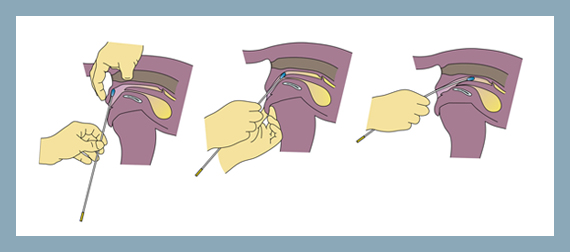 K9 Artificial Insemination in Preston Lancashire